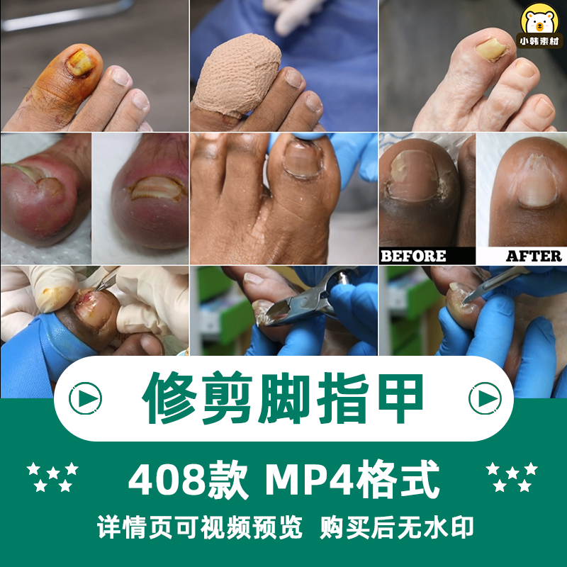 国外高清修脚修死皮剪脚指甲减压视频治愈舒适解压自媒体视频素材插图