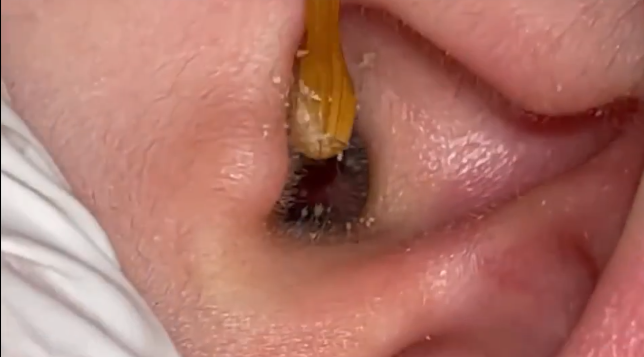 国外助眠直播素材哄睡助眠采耳解压掏耳朵中长高清自媒体视频引流插图9