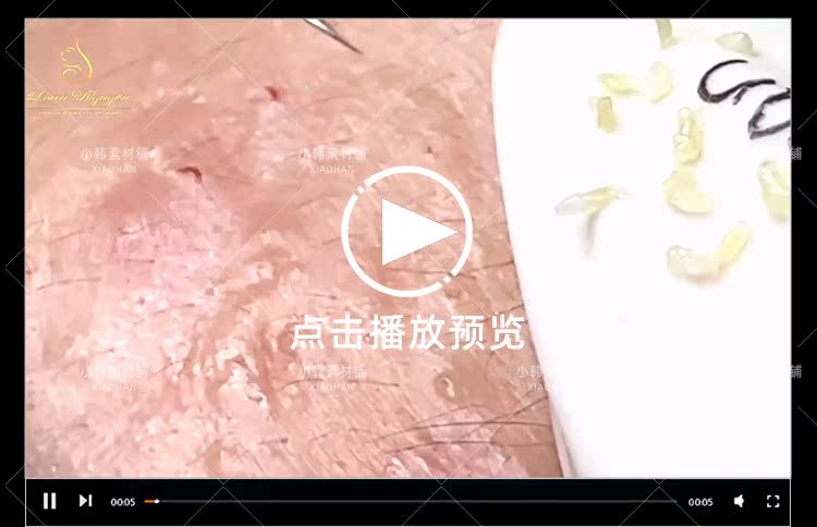 健康解压纪录片祛黑痘全1季中视频自媒体解说高清剪辑视频素材插图5
